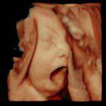 29SSW_05 Ultraschallbild 29 SSW